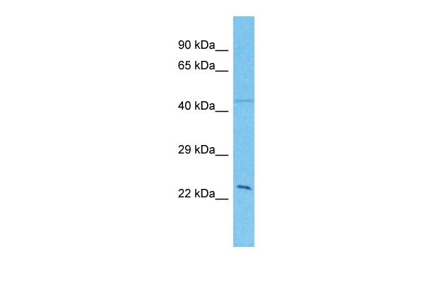 GTF2H3 Antibody - middle region