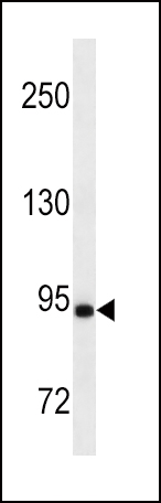 MAP3K12 Antibody (Ascites)