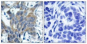 Catenin-beta (Phospho-Ser33) antibody