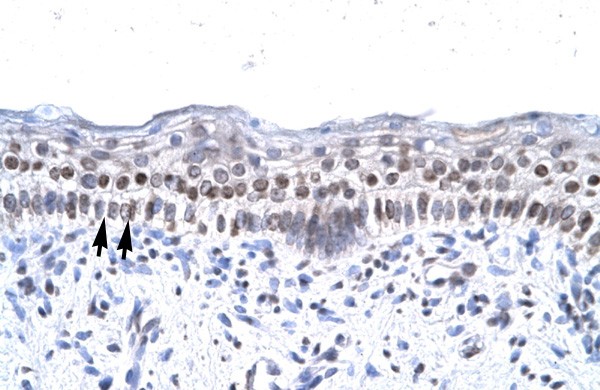 ZNF500 antibody - middle region