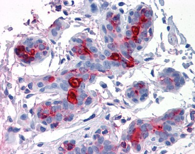 MUC1 Antibody, Monoclonal