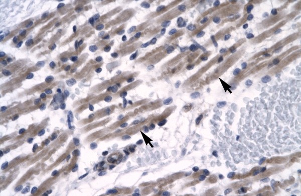 ZNF391 antibody