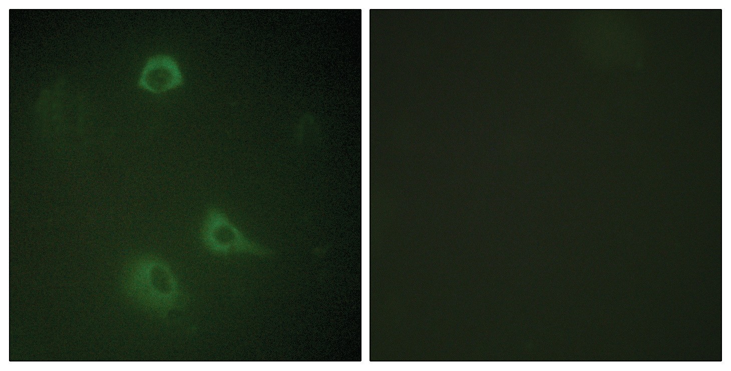 NMDAR1 (phospho Ser890) Antibody