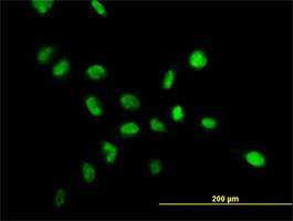 NPM1 Antibody (monoclonal) (M01)