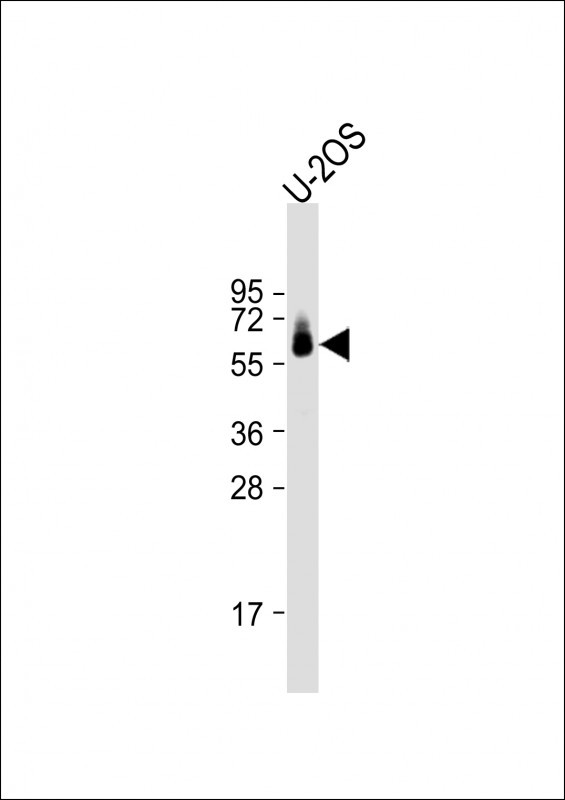 Vimentin Antibody