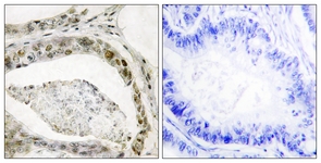Smad3 (Phospho-Ser208) antibody