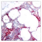 ATF2 (Phospho-Ser62 or 44) antibody