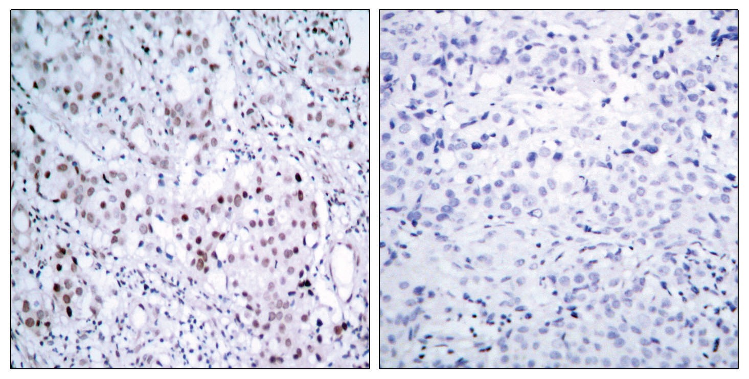 c-Jun (phospho Ser63) Antibody