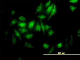 NME2 Antibody (monoclonal) (M08)