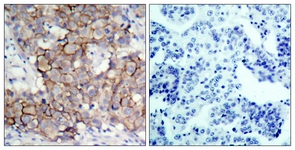 HER2 (Phospho-Tyr877) antibody