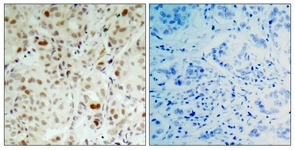 Retinoblastoma (Phospho-Ser807) antibody