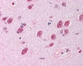 AKT1 Antibody