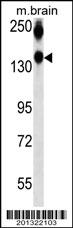 NCAM1 Antibody