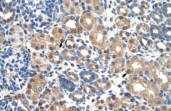 PBX3 antibody - N-terminal region