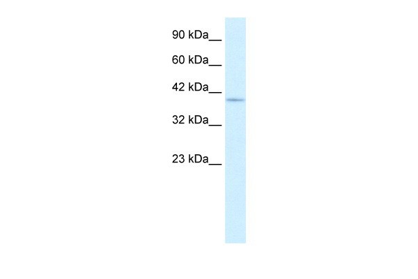 PTK2B antibody - C-terminal region