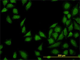 MTAP Antibody (monoclonal) (M01)