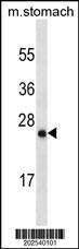 LYPD6B Antibody (Center) (Ascites)