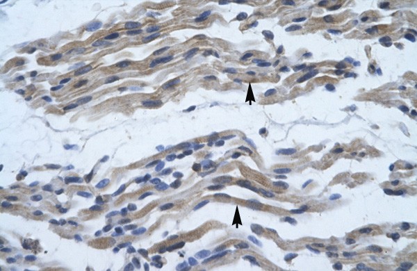 NFKB2 antibody - C-terminal region