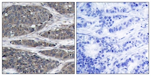 NF-kappaB p105/p50 antibody