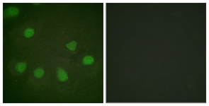 Retinoblastoma antibody