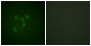 p53 (Acetyl-Lys317) antibody