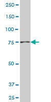 NADSYN1 Antibody (monoclonal) (M01)