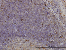 MCF2L Antibody (monoclonal) (M01)