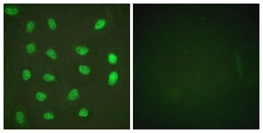 MEF2A (Phospho-Ser408) antibody