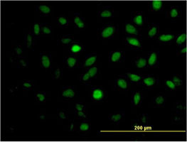 MEIS2 Antibody (monoclonal) (M03)