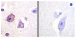 FAK (Phospho-Tyr576) antibody