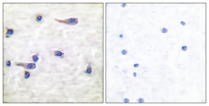 Tau (Phospho-Thr212) antibody
