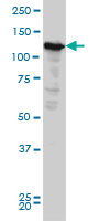 NOPE Antibody (monoclonal) (M03)