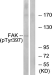FAK (Phospho-Tyr397) antibody