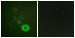 c-Met (Phospho-Tyr1003) antibody
