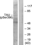Tau (Phospho-Ser396) antibody