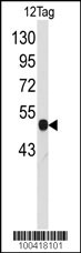 VSV-g Tag Antibody