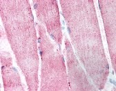 Ribosomal Protein S6 Kinase Antibody