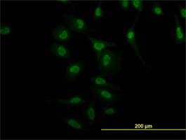 NR4A2 Antibody (monoclonal) (M10)