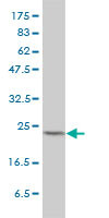 MAD2L1 Antibody (monoclonal) (M01)