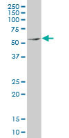 MEF2D Antibody (monoclonal) (M02)