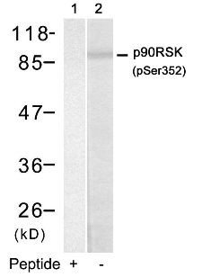 p90RSK (phospho Ser352) Antibody