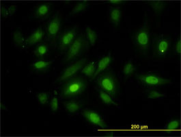 NEK10 Antibody (monoclonal) (M01)