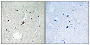 PYK2 (Phospho-Tyr579) antibody