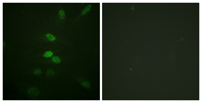 CDC25B antibody