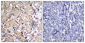 FKHR (Phospho-Ser319) antibody