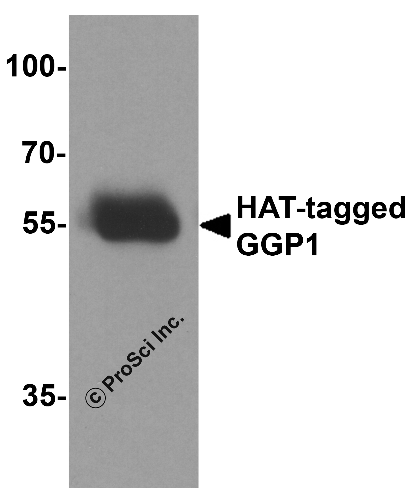 HAT-tag Antibody
