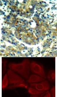 p70 S6 Kinase (phospho Ser411) Antibody