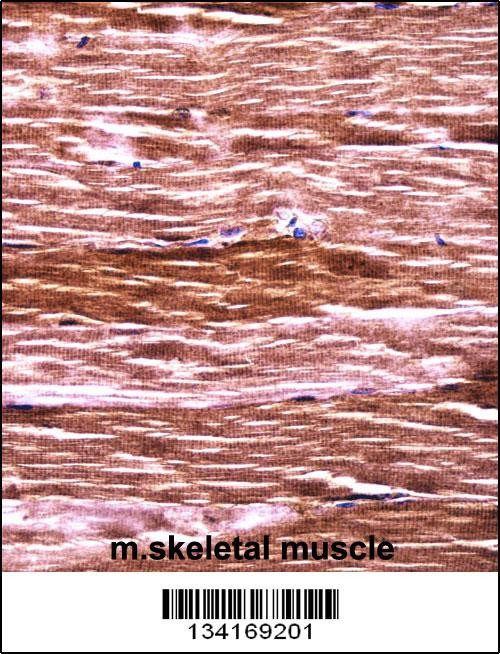Mouse Akt2 Antibody