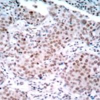 Estrogen Receptor a (phospho Ser104) Antibody