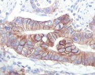 IGF1R Antibody